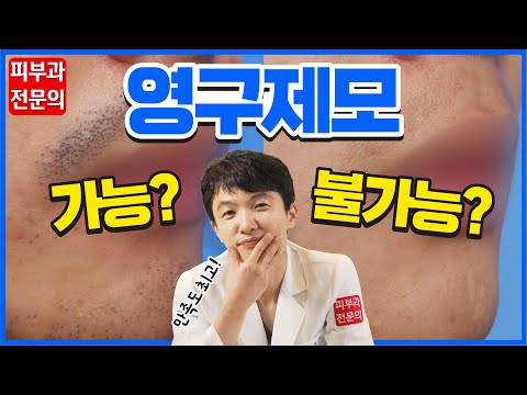 Meta 털 안나게 하는 약 – 탈모 예방 및 머리카락 관리에 효과적인 솔루션