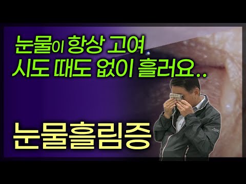 눈물 이 계속 나와요 해결책 | 눈건강을 위한 전문 조언 – Achievetampabay