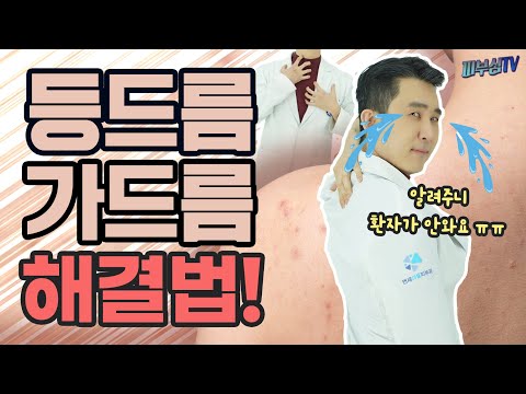 등드름 가드름 없애는 법! [피부과전문의 피부심]