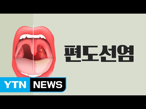 목이 부었을 때 아이스크림: 목 통증 완화에 탁월한 선택지!