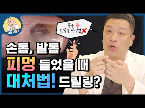 발톱이 빠지려고 하면 깨끗한 밴드를 사용해 보호하고, 감염을 예방하기 위해 항균제를 사용하세요. 통증이 심하거나 발톱 주변이 붓는다면 의사와 상담하세요.