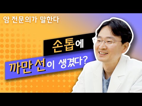 Q. 손톱에 까만 선이 생겼다? 어떻게 해야 하나요? [피부암]