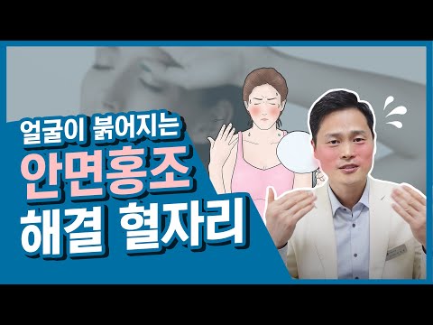 얼굴이 붉어지는 안면홍조 가라앉혀주는 혈자리[갱년기, 호르몬, 자율신경장애, 과로, 화병]